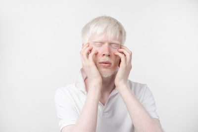 Young man with albino against white background