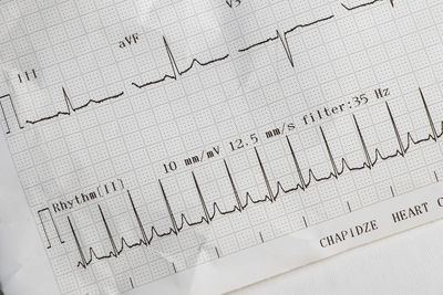 Cardiogram, waves of heart beat, ekg on the paper, arrhythmia