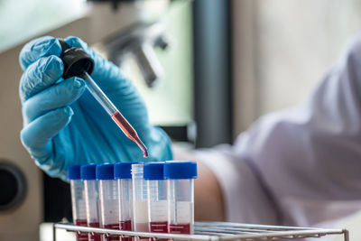 Cropped hand of scientist working in laboratory