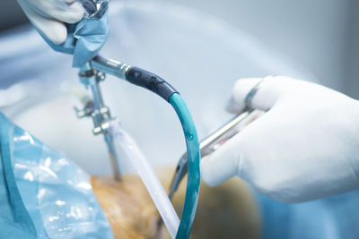 Cropped hand of doctor operating patient in hospital