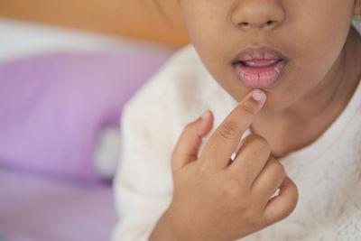 Close up of dry lip of a child