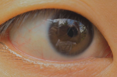 Close-up of human eye